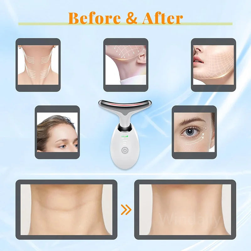 Household Thermal Neck Lifting & Firming Anti-Wrinkle Electric Face Massager –  Skin Tightening & Face Rejuvenation Device