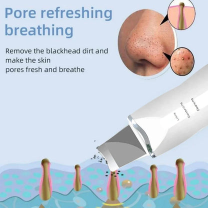 Ultrasonic Skin Scraper – Deep Pore Cleansing Facial Device for Men & Women, Professional Skin Care Tool