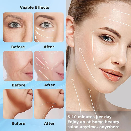 Household Thermal Neck Lifting & Firming Anti-Wrinkle Electric Face Massager –  Skin Tightening & Face Rejuvenation Device