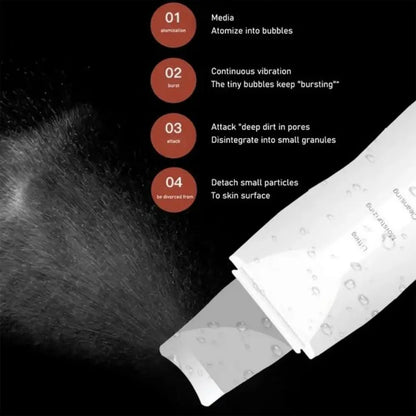 Ultrasonic Skin Scraper – Deep Pore Cleansing Facial Device for Men & Women, Professional Skin Care Tool