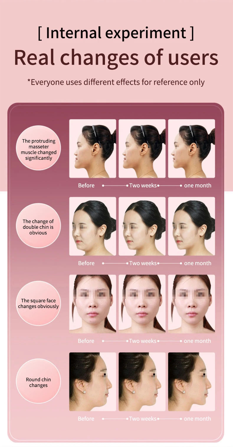 LED Photon Therapy Facial Lifting & Slimming Massager – Heated V-Face Double Chin Reducer & Skin Tightening Device
